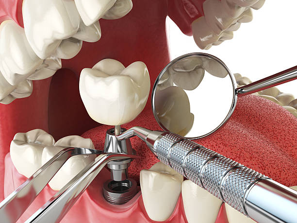 Best Emergency Dental Clinic in NE